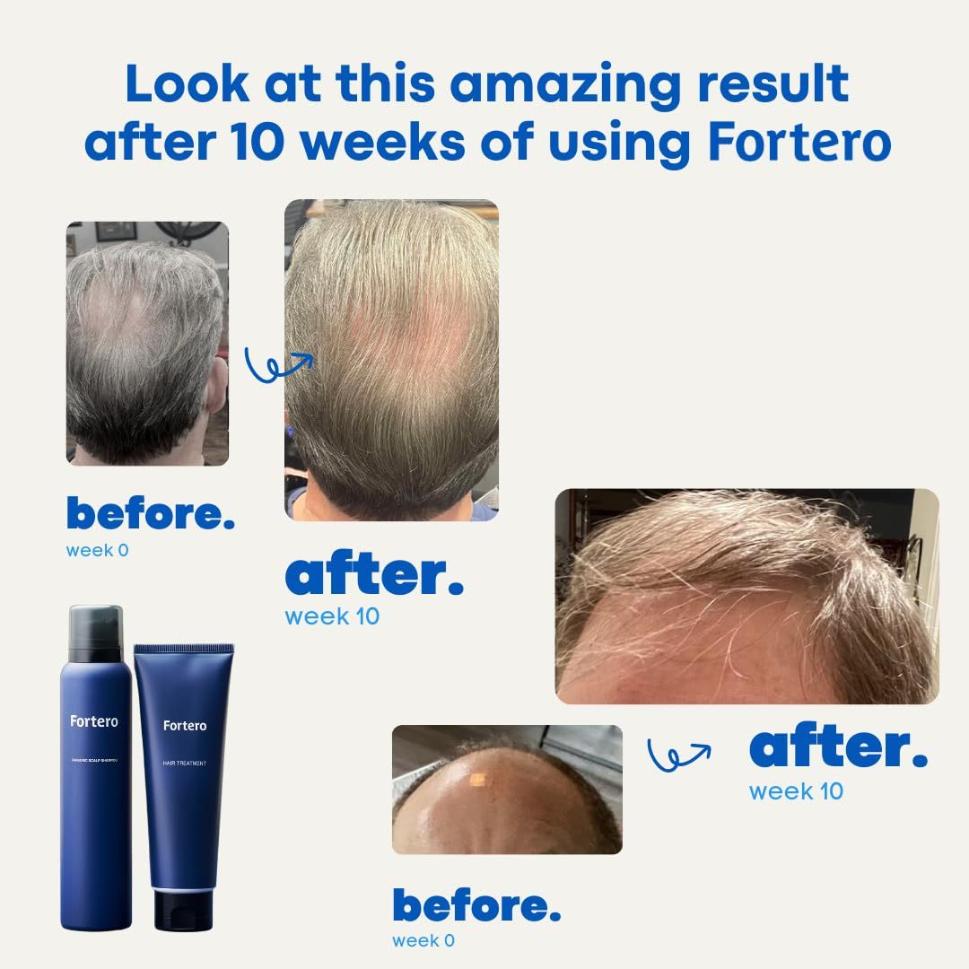 Fortero Men's Anti-Thinning Conditioner for Fuller-Looking Hair